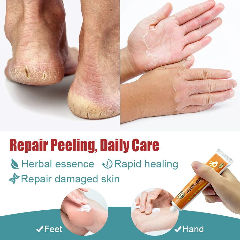 

snake oil Chapped Heel Skin Repair Cream Heel Exfoliate Ointment Hand Feet Skin Anti Drying Moisturizing Repair Skin Care Cream