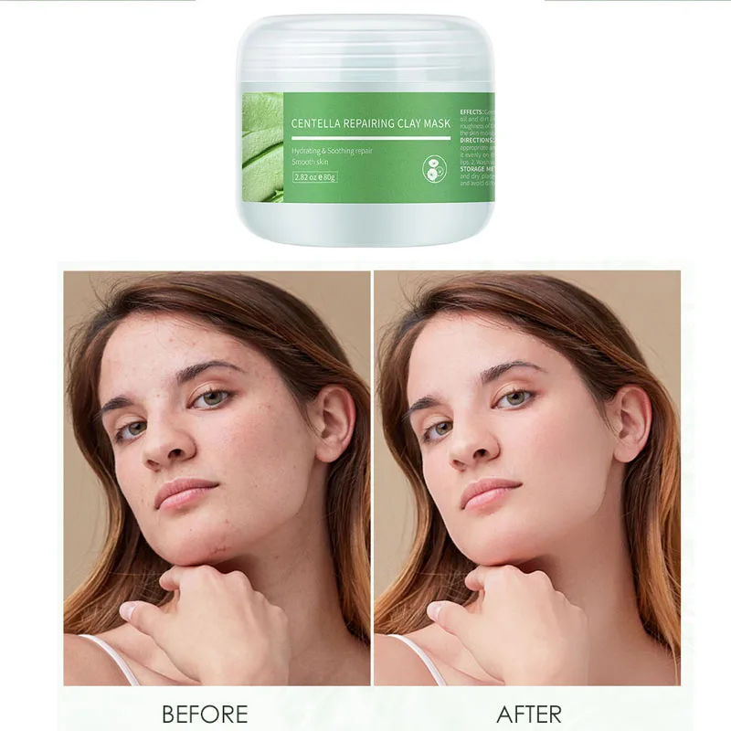 

Centella Asiatica Repairing Mud Film Relieve Skin Relieve Skin Redness And Remove Acne Repair Pores Moisturize And Urish Skin