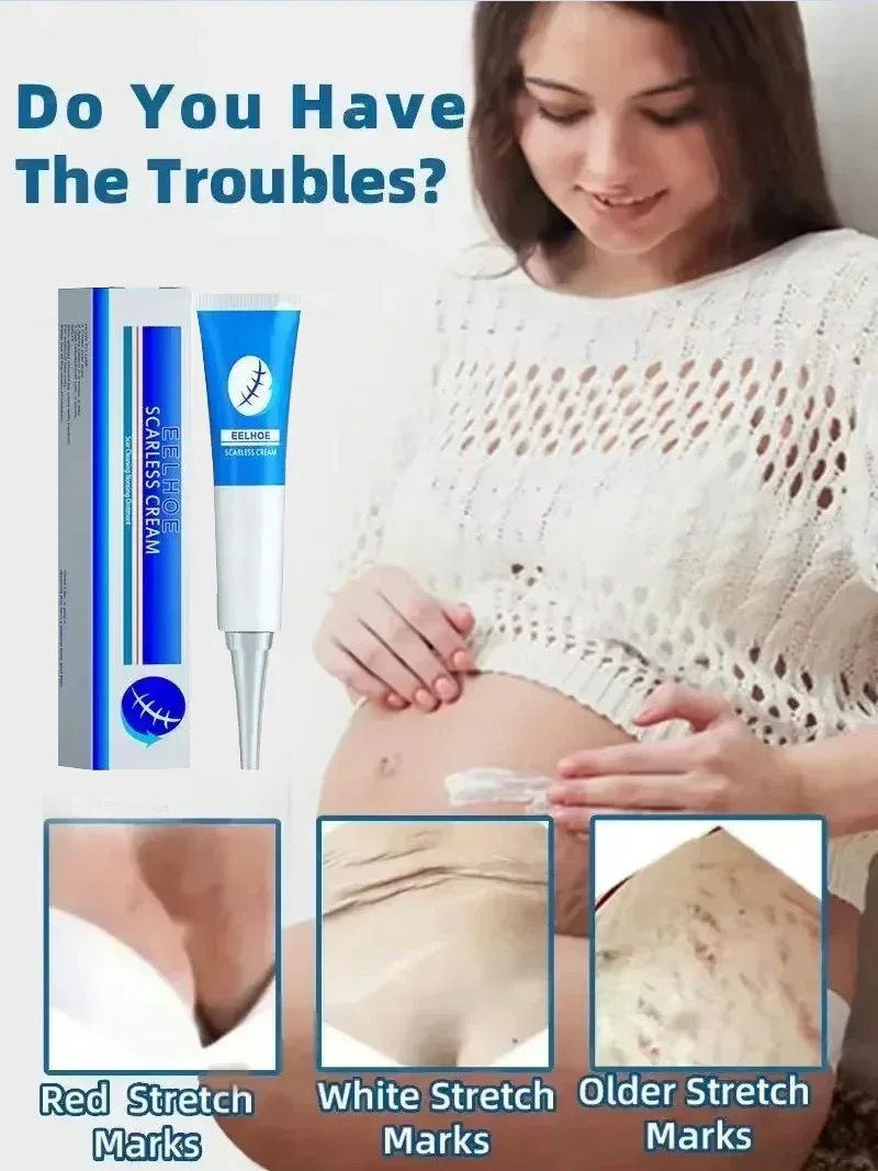 Нераздражающий крем от растяжек восстанавливающий шрам сукна линия для