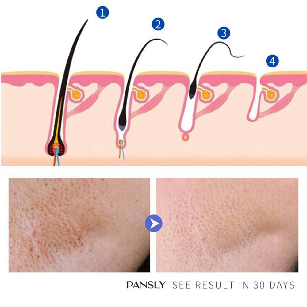 

Mild Hair Inhibitor Cream Skin Care Solution For Arm