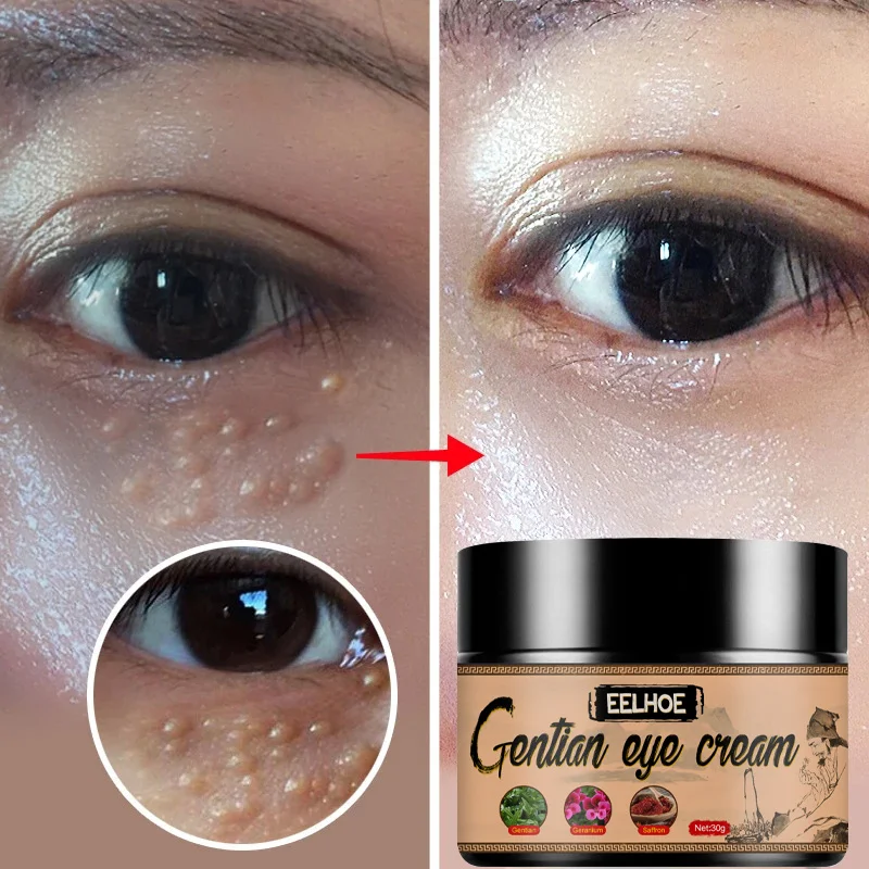 

Effective Removes Fat Granules Eyes Cream Improve Eye Bag Fine Lines Moisturizing Anti-Puffiness Lifting Firming Eye Care Serum