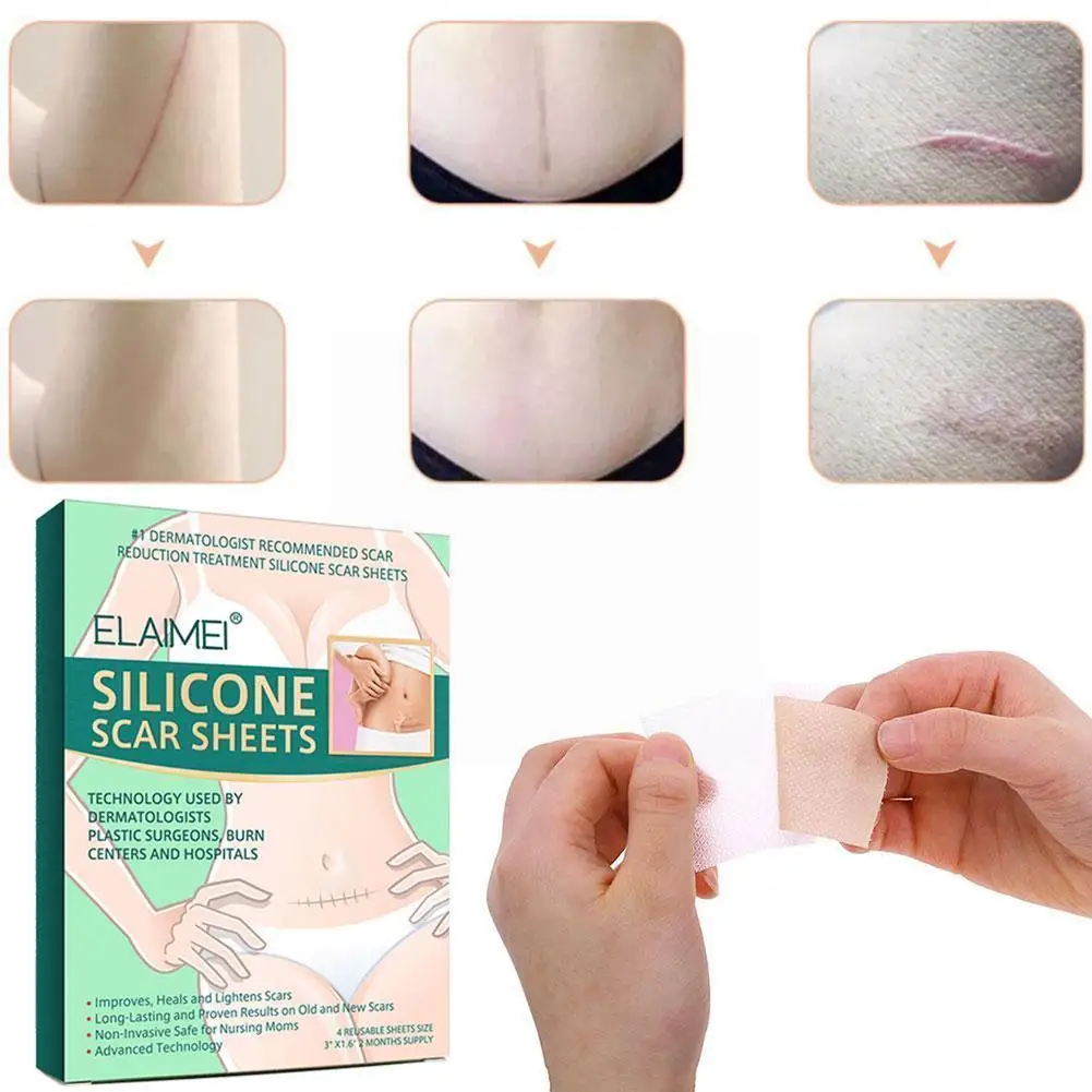

Reusable Silicone Scar Sheets Removal Patch Acne Gel Patch Sheet Repair Remove Skin Therapy 2022 Trauma Silicon Scar Burn A8M6