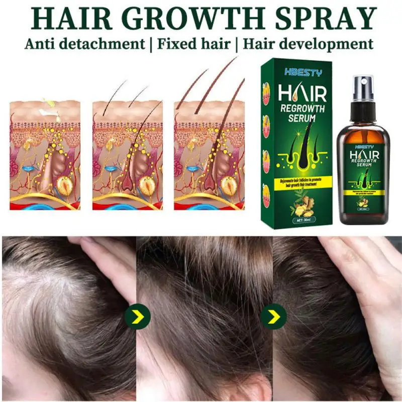 

Имбирное масло для быстрого роста волос, эссенция для роста волос, масло для предотвращения облысения, лечения кожи головы, красоты и здоровья