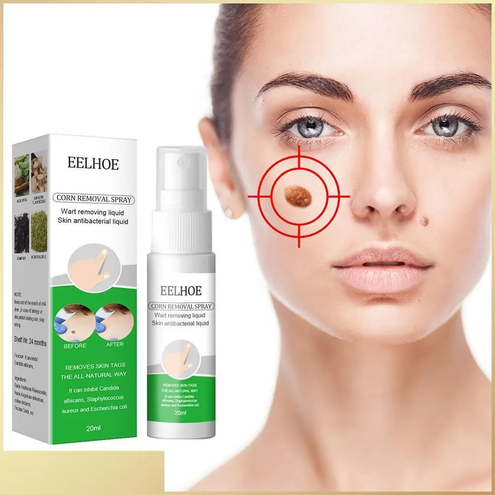 

New 20 Ml Wart Treatment Spray Foot Corn Removal Plantar Warts Liquid Body Black Dots Mole Wart Skin Tag Remover Plaster