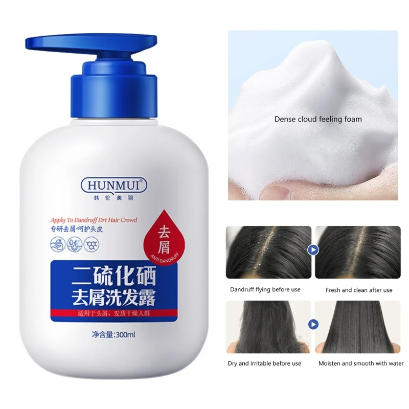 

Selenium Disulfide Shampoo Hair Product Nourishing Repairing Anti-dandruff Anti-itch Shampoos Nourishing Hair Care New Dropship