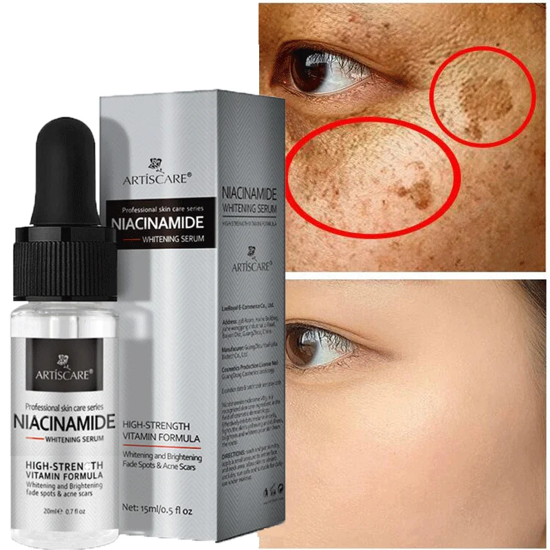 

Effective Whitening Serum Remove Dark Spots Freckle Essence Anti-Aging Niacinamide Fade Pigmentation Melasma Brighten Skin Care