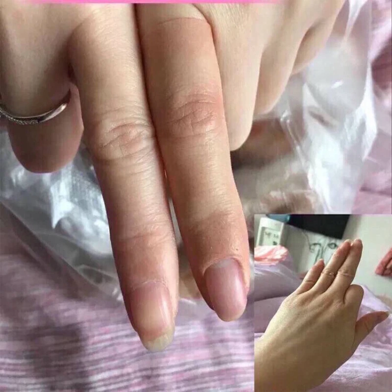 The disabled finger fake finger glove the disabled finger custom-made fake palm simulation finger