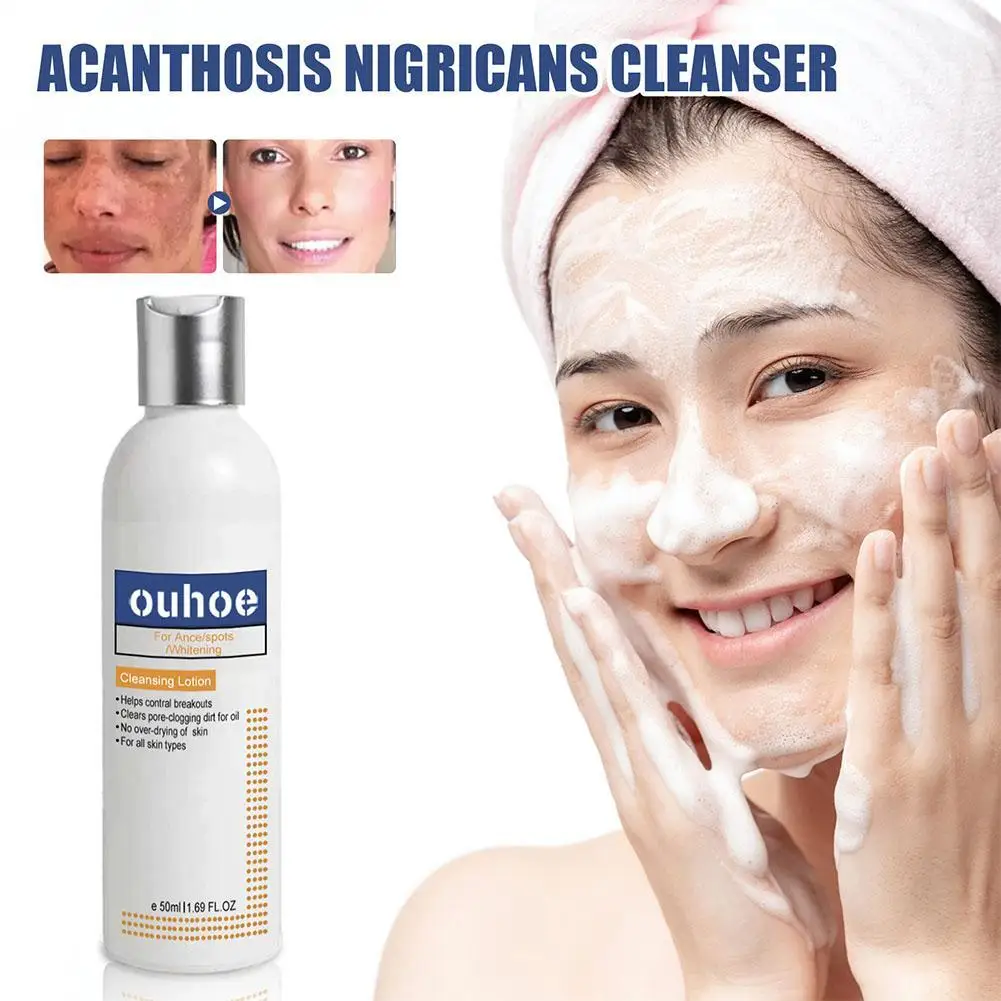 

Whitening Facial Cleanser Bleach Remove Melasma Dark Spots Improve Dull Lighten Pigmentation Moisturizing Brighten Skin Care