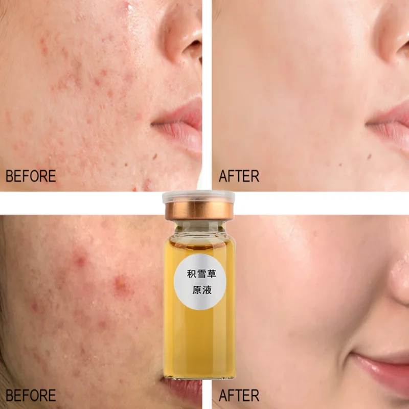 Снежная степная жидкая эссенция для мужчин и женщин косметика витамин ухода за