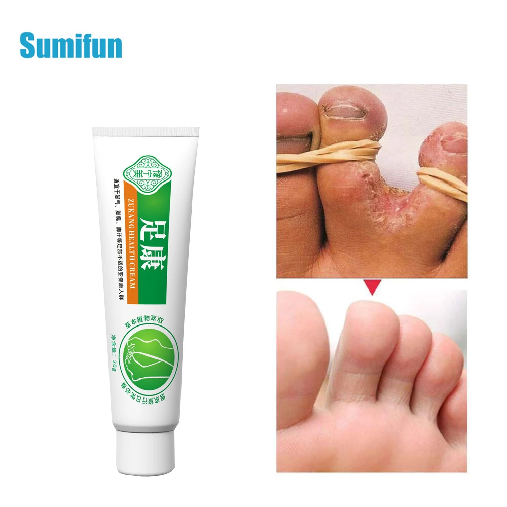 

1Pc Foot Anti Fungal Foot Spray Remove Itching Relieving Beriberi Sterilize Toe Deodorant Treatment Onychomycosis Product