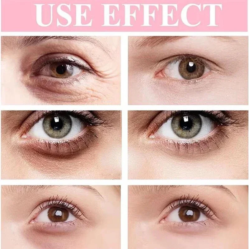 Крем для области вокруг глаз от морщин и тёмных кругов