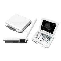 sya 005wd multi functional portable laptop ultrasound scanner with 12 inch lcd display
