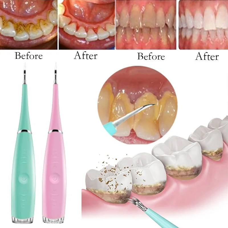 

2021 Sonic Dental Scaler Tooth Calculus Electric Remover Tartar for Teeth Tooth Stains Clean Tool Dentist Flosser Dental Clean