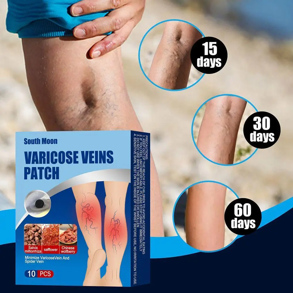 

10 pcs Varicose Veins Patch Treat Vasculitis Phlebitis Leg Angiitis Spider Removal Swelling Pain Relief Adhesive Plaster