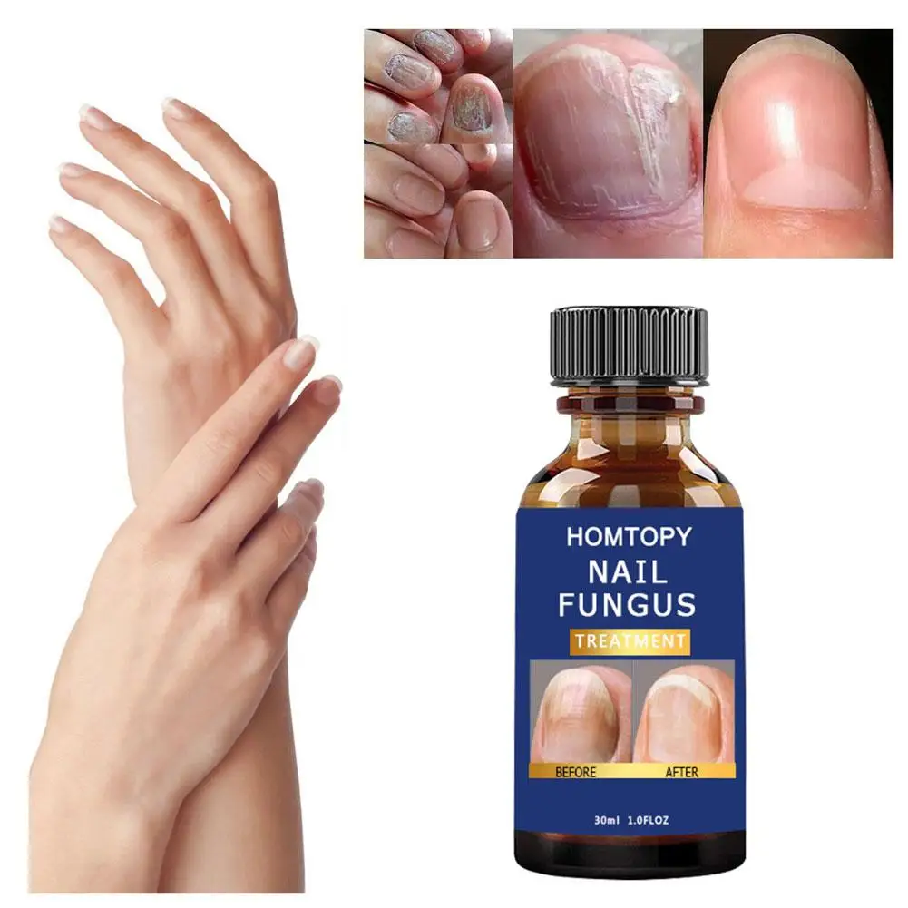 Рисунок 6 - Отвердитель для ногтей