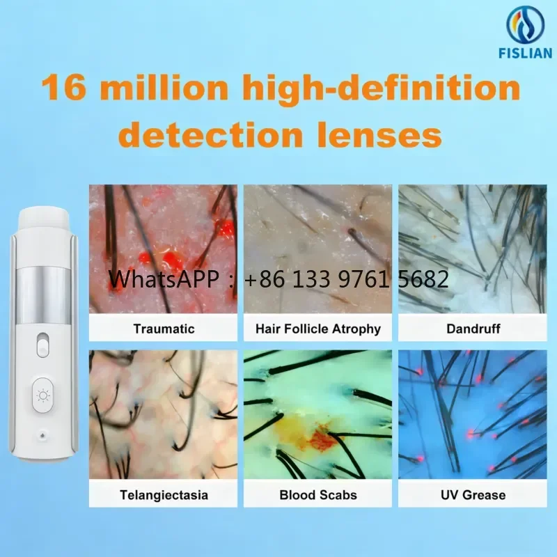 Фото Портативный сканер кожи головы WSQ Advanced Scalp Scanner с AI-анализом волос, 16 МП HD, 10/50/100/200X увеличение, Fislian FS-TP01, гарантия 1 год, для домашнего использования №5