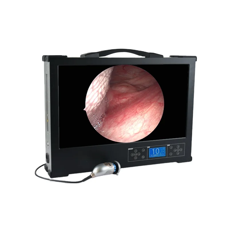 Эндоскопические камеры для ладоскопа Full HD/оборудование эндоскопии