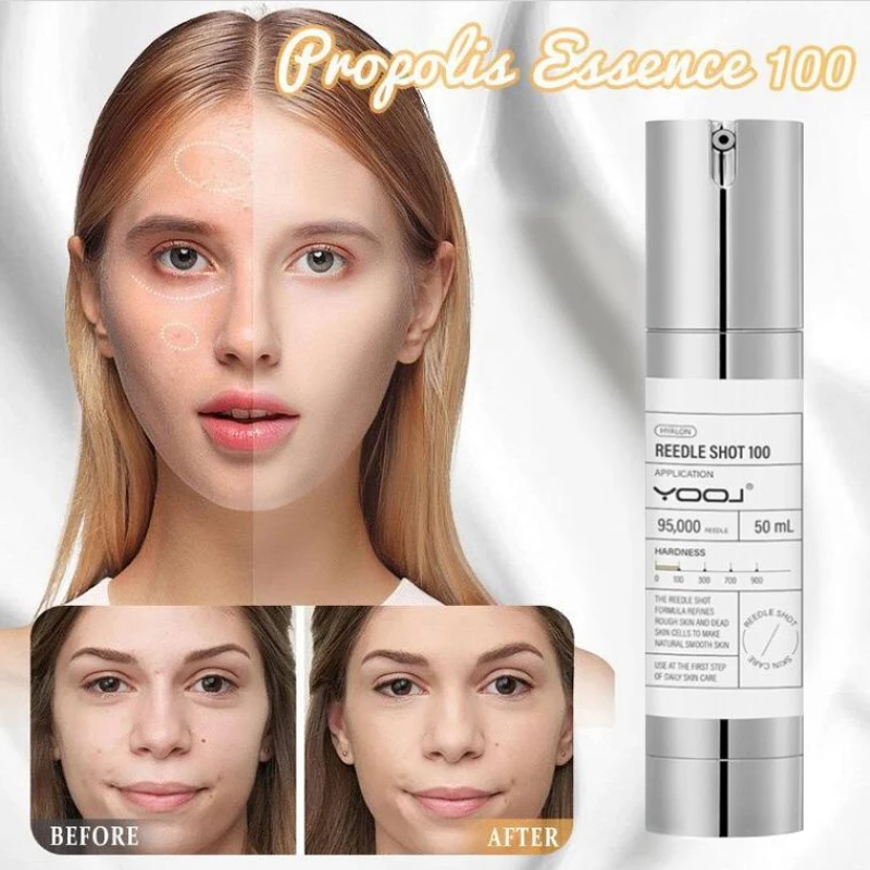 Фото REEDLE SHOT 100, губка с микроиглами, эссенция, алоэ вера, центелла, азиатская эссенция с прополисом, увлажняющая осветляющая эссенция для тонких линий №2