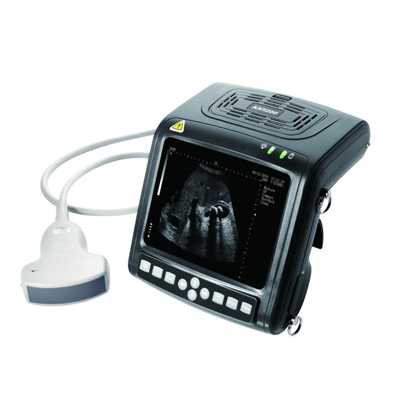 

KX5200 Goat Cow Equine Pregnancy Test Vet Digital B Mode Ultrasound Scanner For Veterinary Animal Ultrasonic Equipment Portable