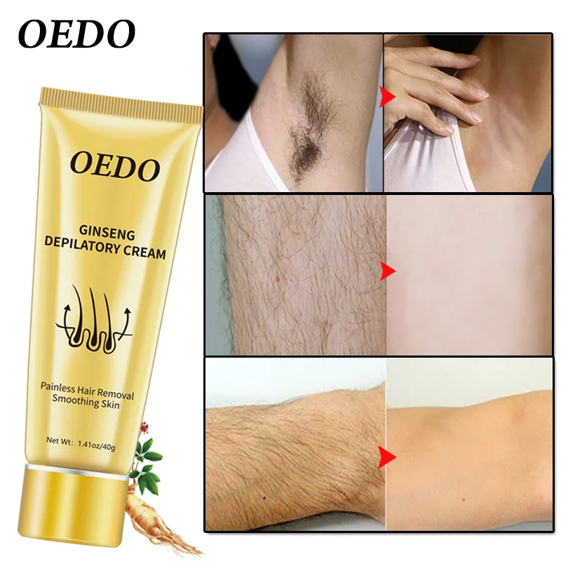 

Ginseng Body Hair Removal Cream for Men and Women Hand Leg Hair Loss Depilatory Cream Removal Armpit Depilatory Cream