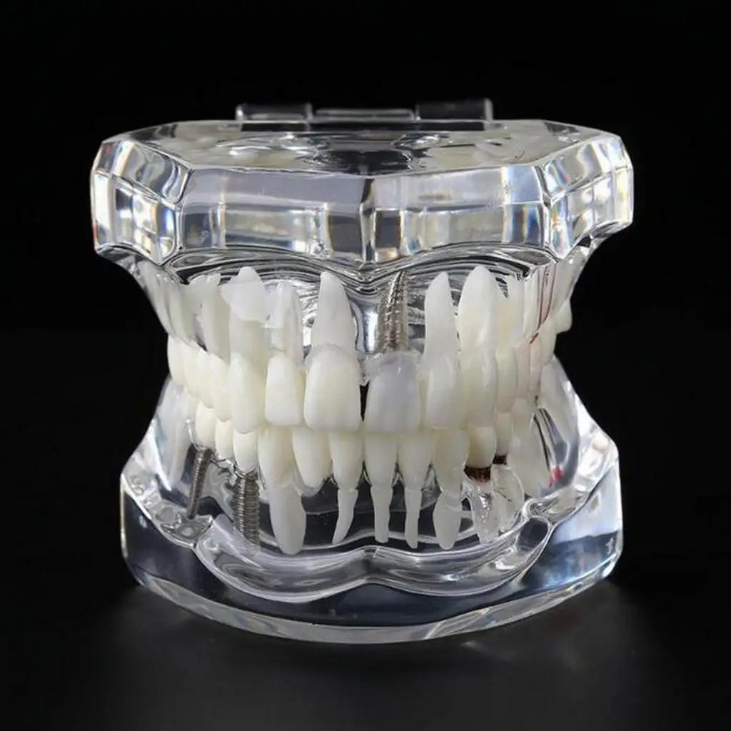 

1pc Transparent Study Teeth Model with Nerve Repair Demonstration