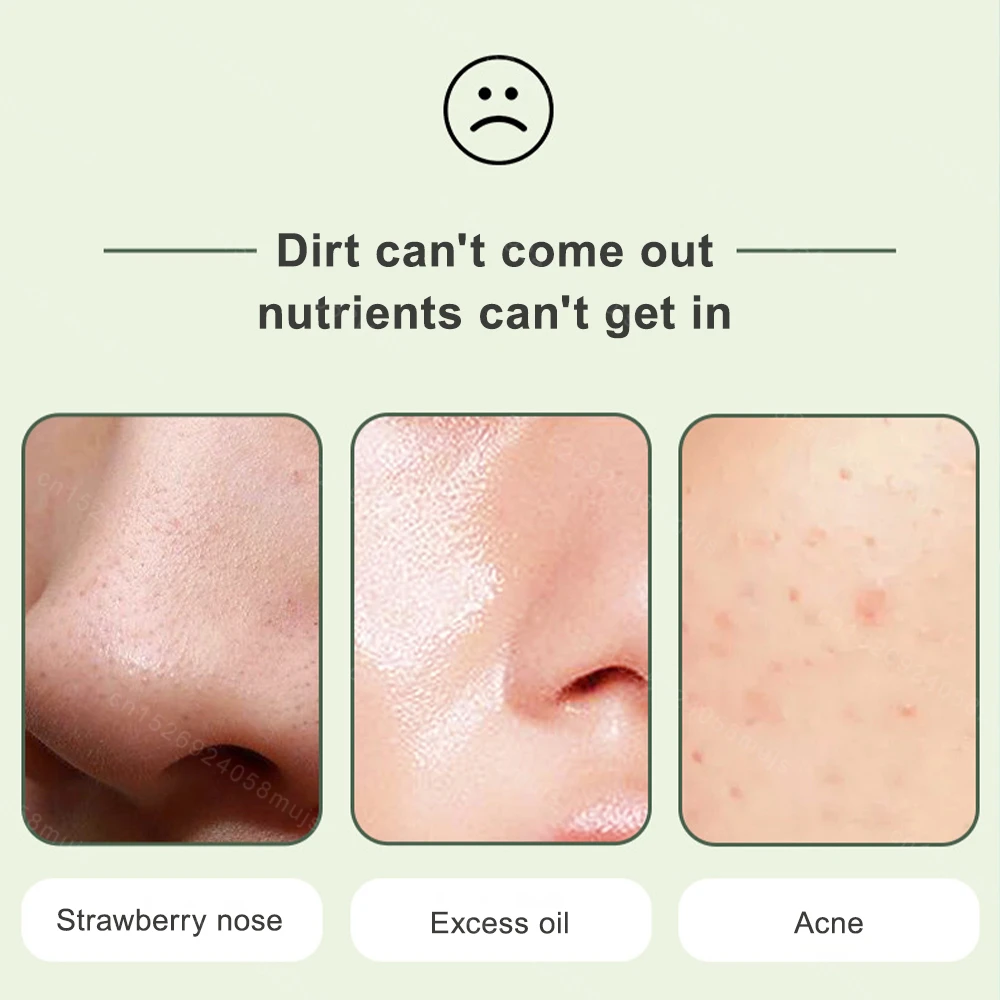 Средство для удаления черных точек средство очистки устройство сужения пор