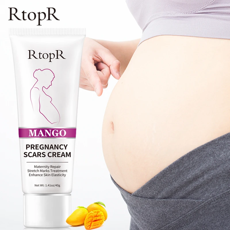 

Крем от шрамов RtopR, манго, 40 г, для восстановления кожи, от морщин, удаления шрамов, после родов