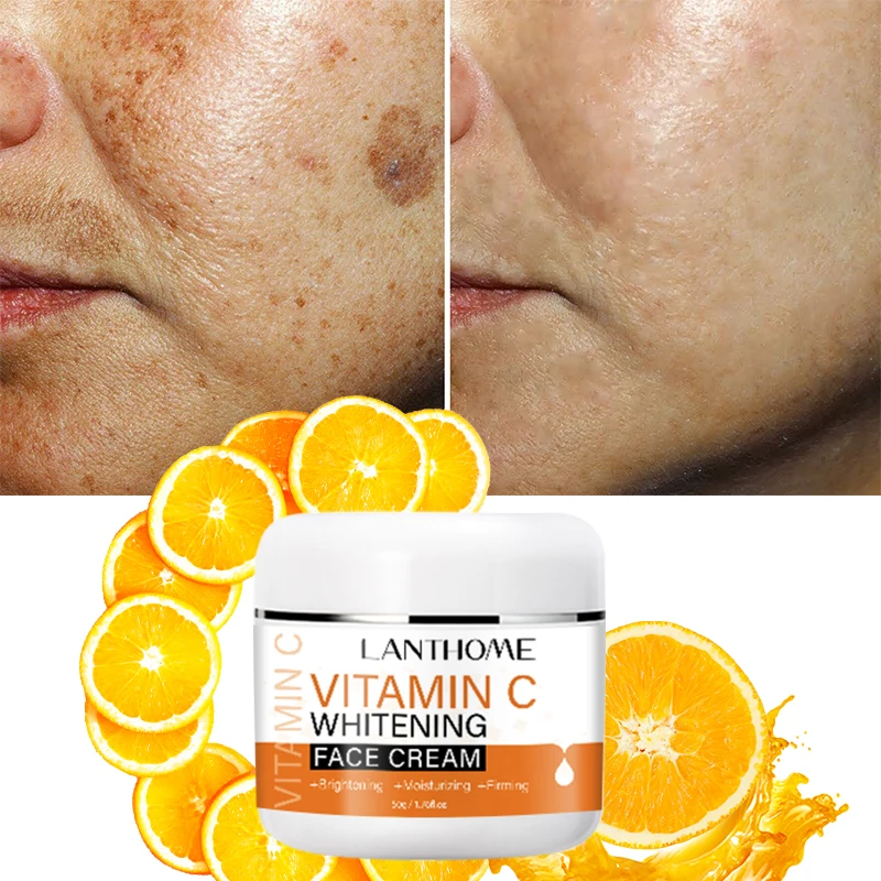 

Vitamin C for Face Whitening Remover Dark Spots Pigment Spots Freckles Skin Care Cream Anti-Wrinkle Aging Moisturizing Cream