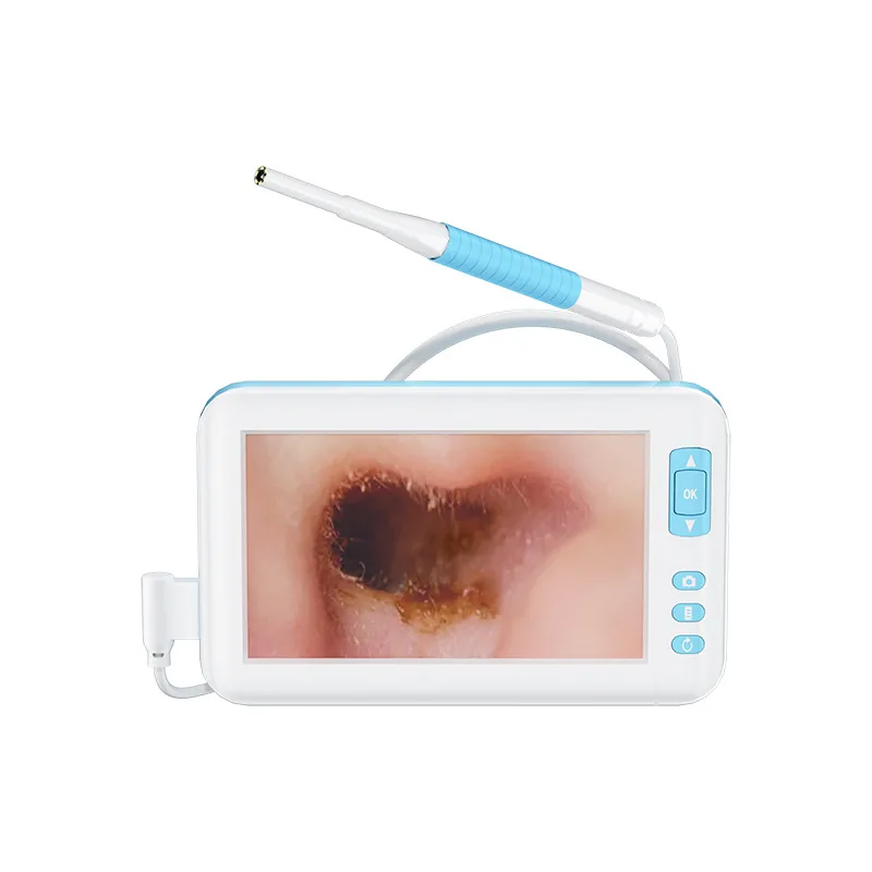 【200Ten Thousand】Экран высокой четкости визуальный ушной выбор коммерческое