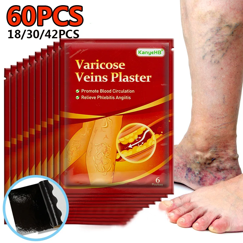 

Varicose Veins Patch Vasculitis Phlebitis Leg Medical Plaster Treatment Varicosity Angiitis Stickers Angiitis Removal Ointmnet