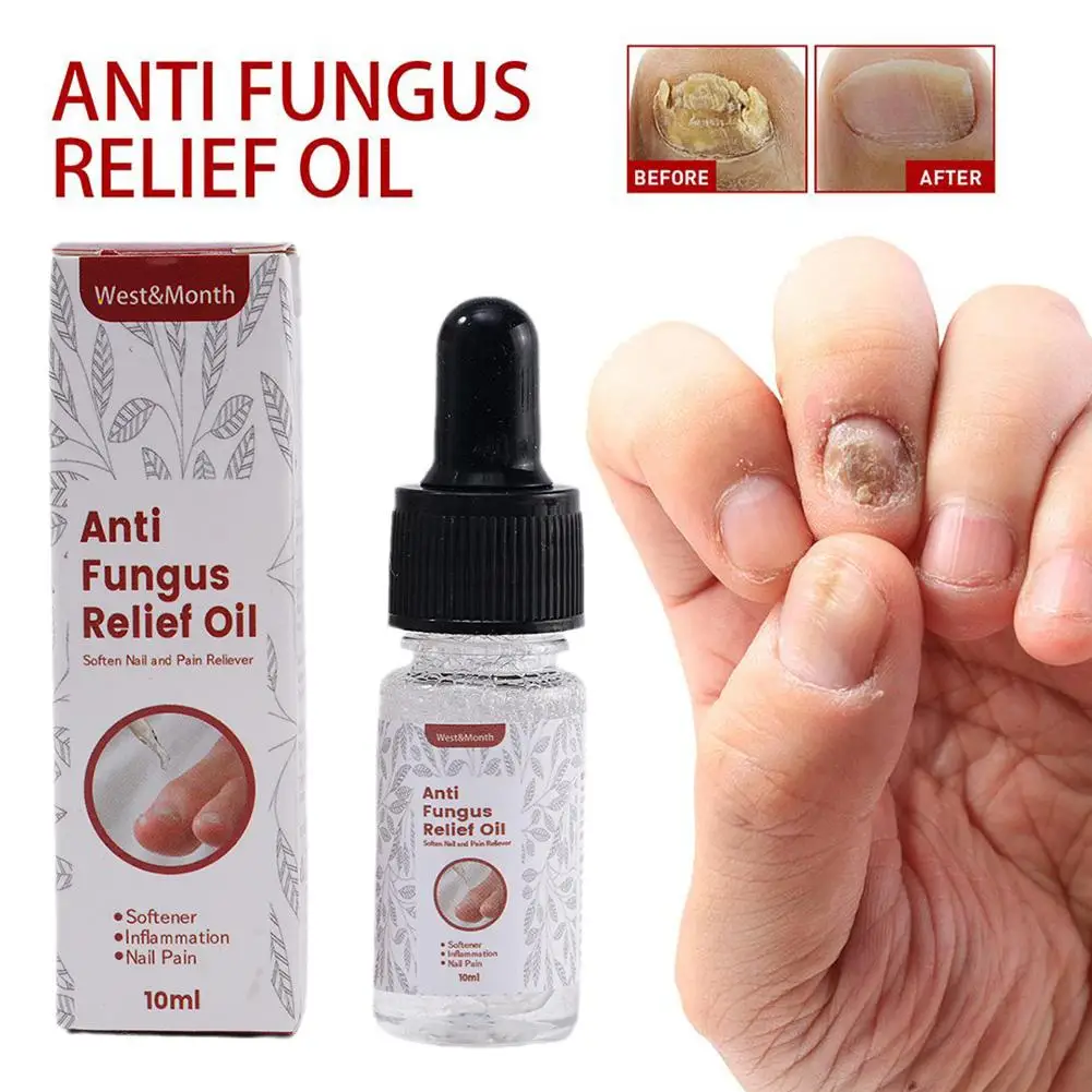 

10ML Anti Paronychia Relief Oil Ingrown Toenail Drops Ingrown Nail Treatment Fungal Anti Stop Onychomycosis Corrector Pain Z5E0