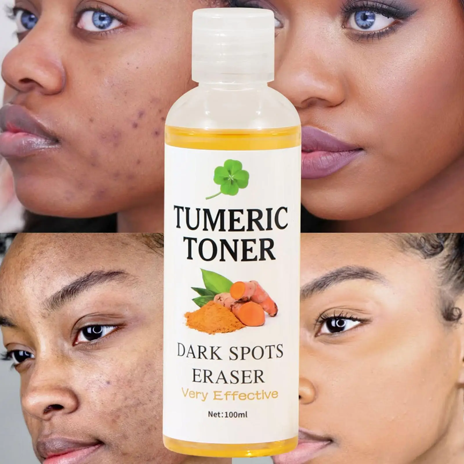 100ml Tumeric Dark Spots Toner Spots Eraser Corrector Turmeric Fade Blemishes Dark Spot Remover Acne Remover Toner for Dark Skin