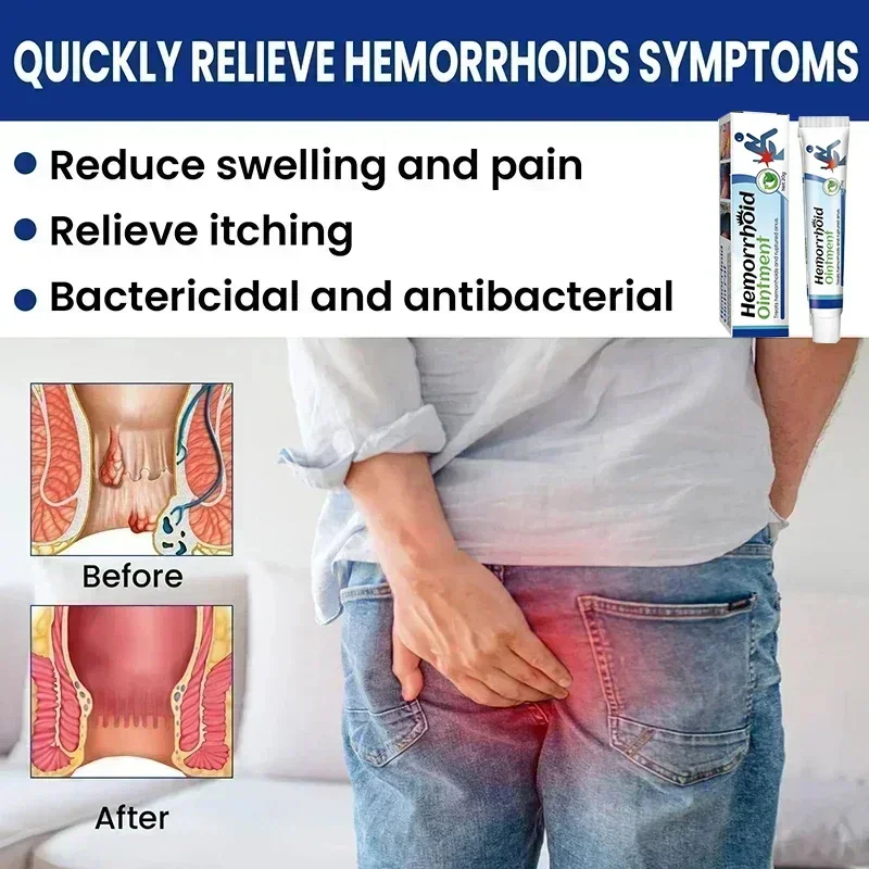 Крем для удаления геморроя внутренний натуральный экстракт трав облегчение