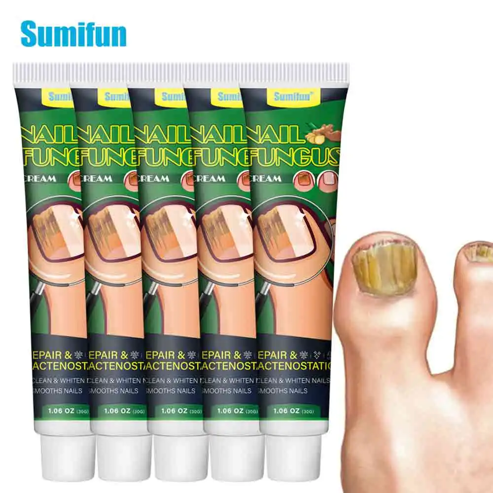 1/3/5/10/15/20шт 30г