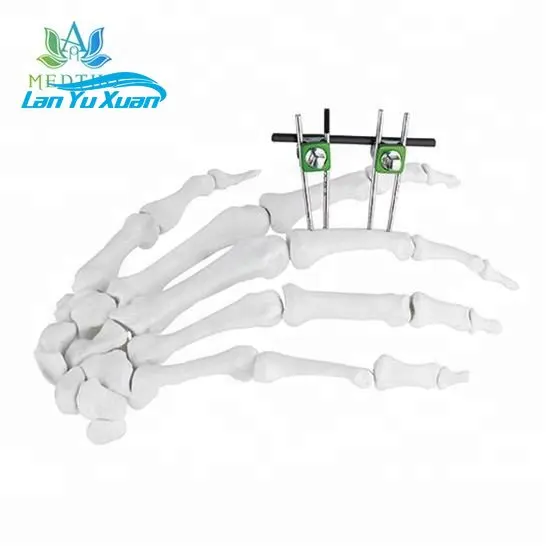 

orthopedic external fixation external fixator Finger and Palm External Fixator