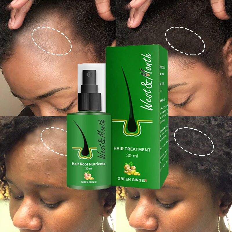 

Ginger Hair Growth Spray Essential Oil Hair Loss Treatment Fast Growth Solid Hair Follicle Black Hair Growth Nourishing Liquid