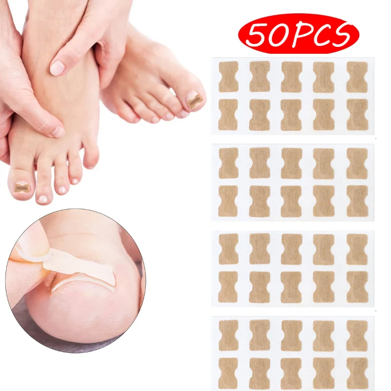 

50pcs Nail Correction Stickers Ingrown Toenail Corrector Patches Paronychia Treatment Recover Corrector Pedicure Manicure Tools