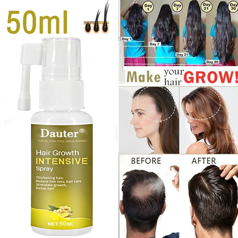 

Жидкость для роста волос против выпадения волос способствует густым и быстрому росту волос, эфирное масло для здоровья, 10/20/30/50 мл