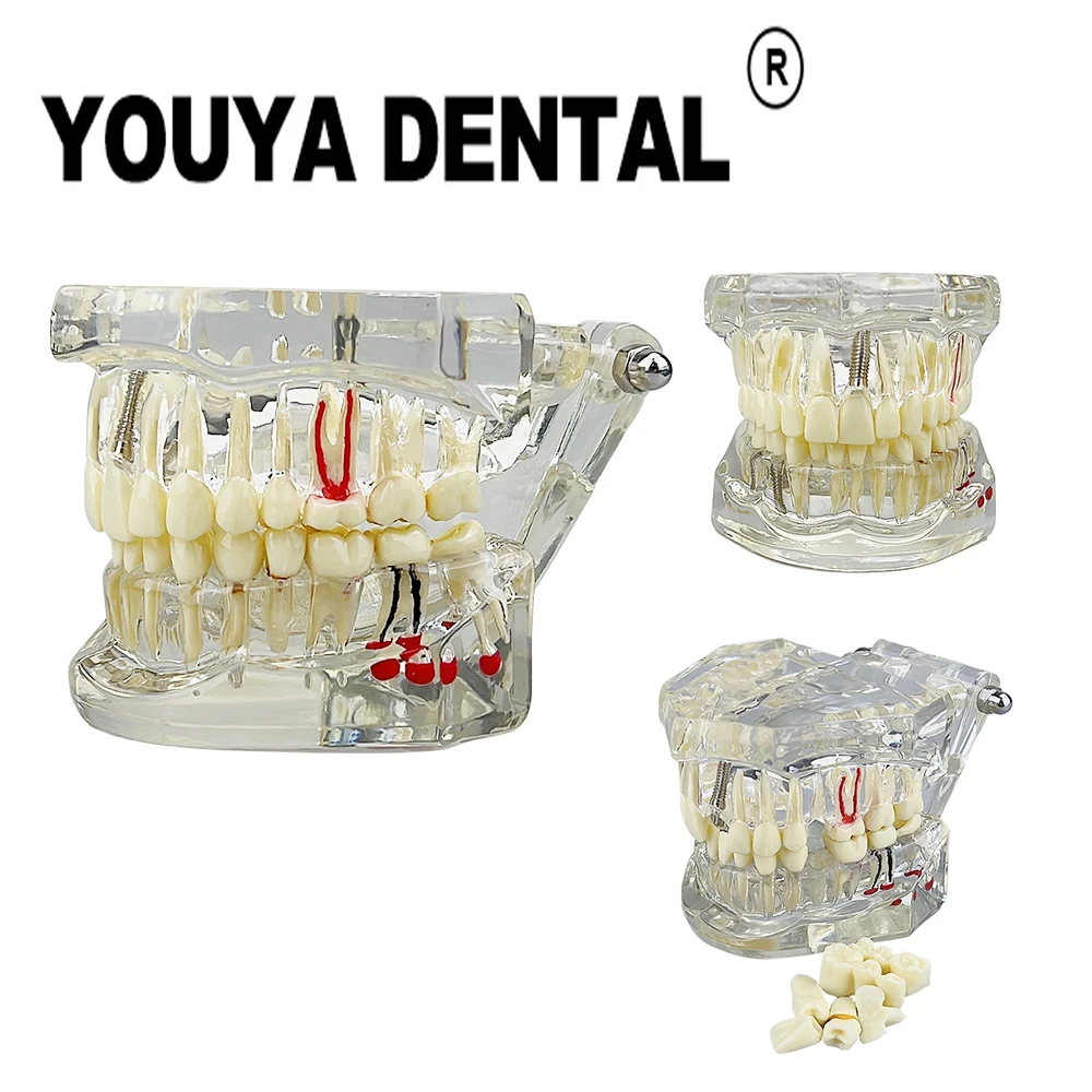 Модель для коррекции зубов прозрачная модель стоматолога студенческая практика