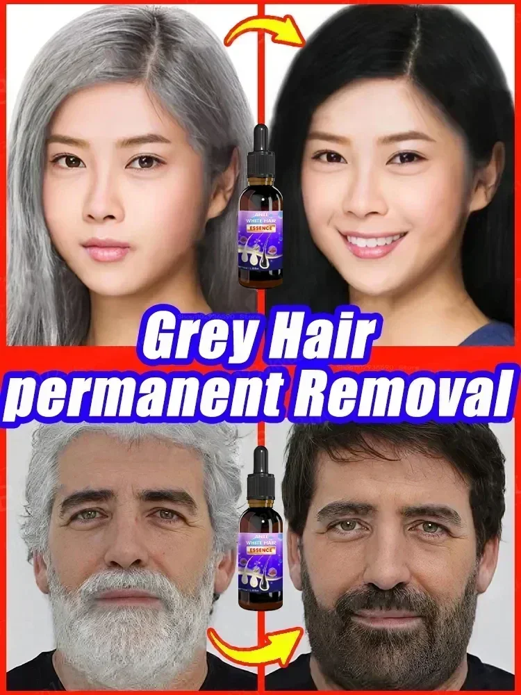 Сыворотка пераватан rambut abu-abu nutrisi perbaikan warna alami ke Hitam perawatan Rambut rontok Pria Wanita