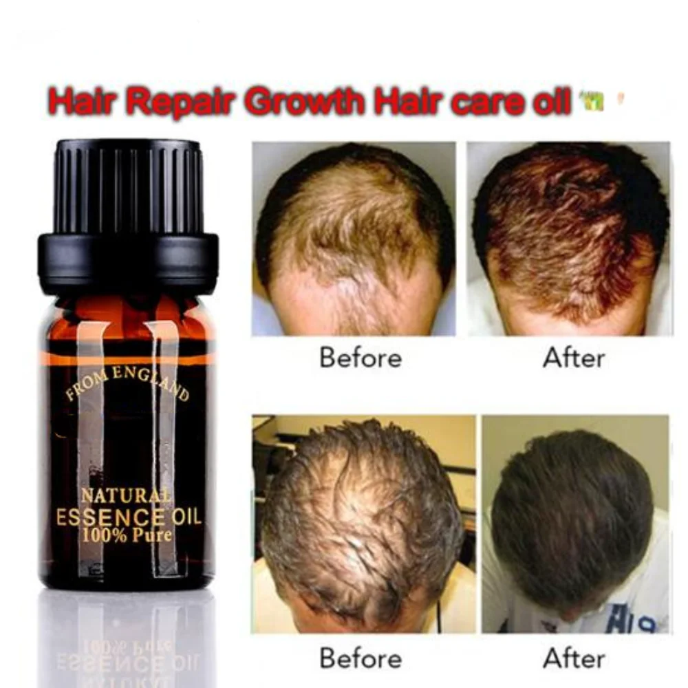 

Hair Care Fast Powerful Hair Growth Products Regrowth Essence Liquid Treatment Preventing Hair Loss for Men Women 10ml Oil