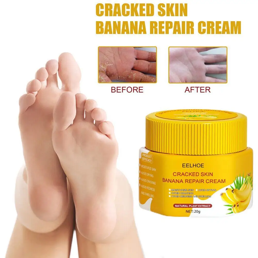 

20g Natural Banana Oil Moisturizing Cracked Heel Balm Foot Hand Skin Repair Cream Anti-Drying Smooth Dead Skin Removal Ointment