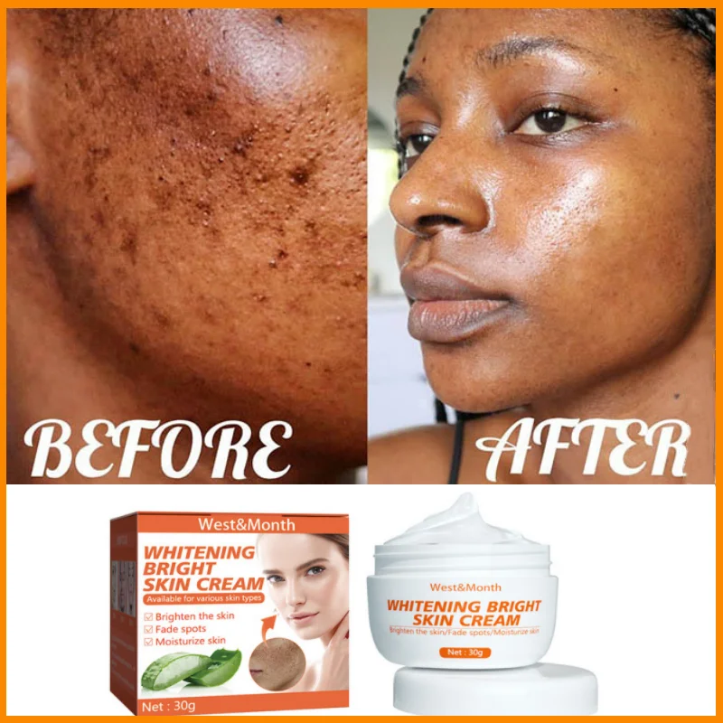 

Affordabl Effective Spot Remover Face Cream Whitening Dark Skin Fade Pigment Freckles Melasma Brighten Skin Care Beauty Products