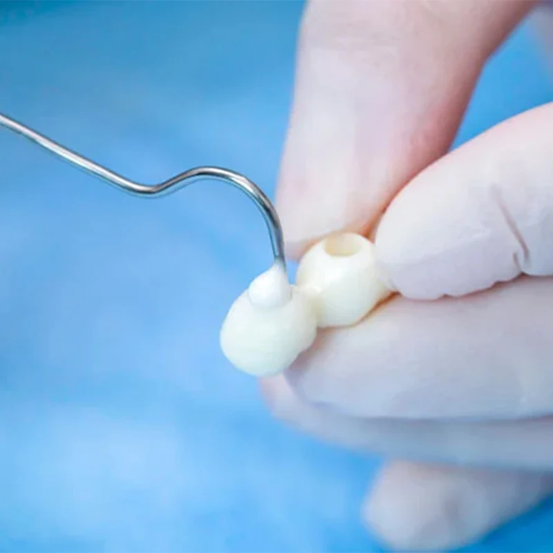 VVDental стеклоиномер цемент склеивание тип I бутылка восстановление зубов материал