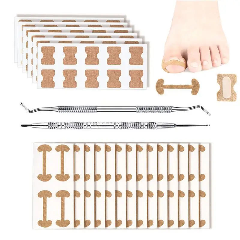 

Корректор для вросших ногтей наклейки для коррекции вросших ногтей Witn инструмент для коррекции ногтей