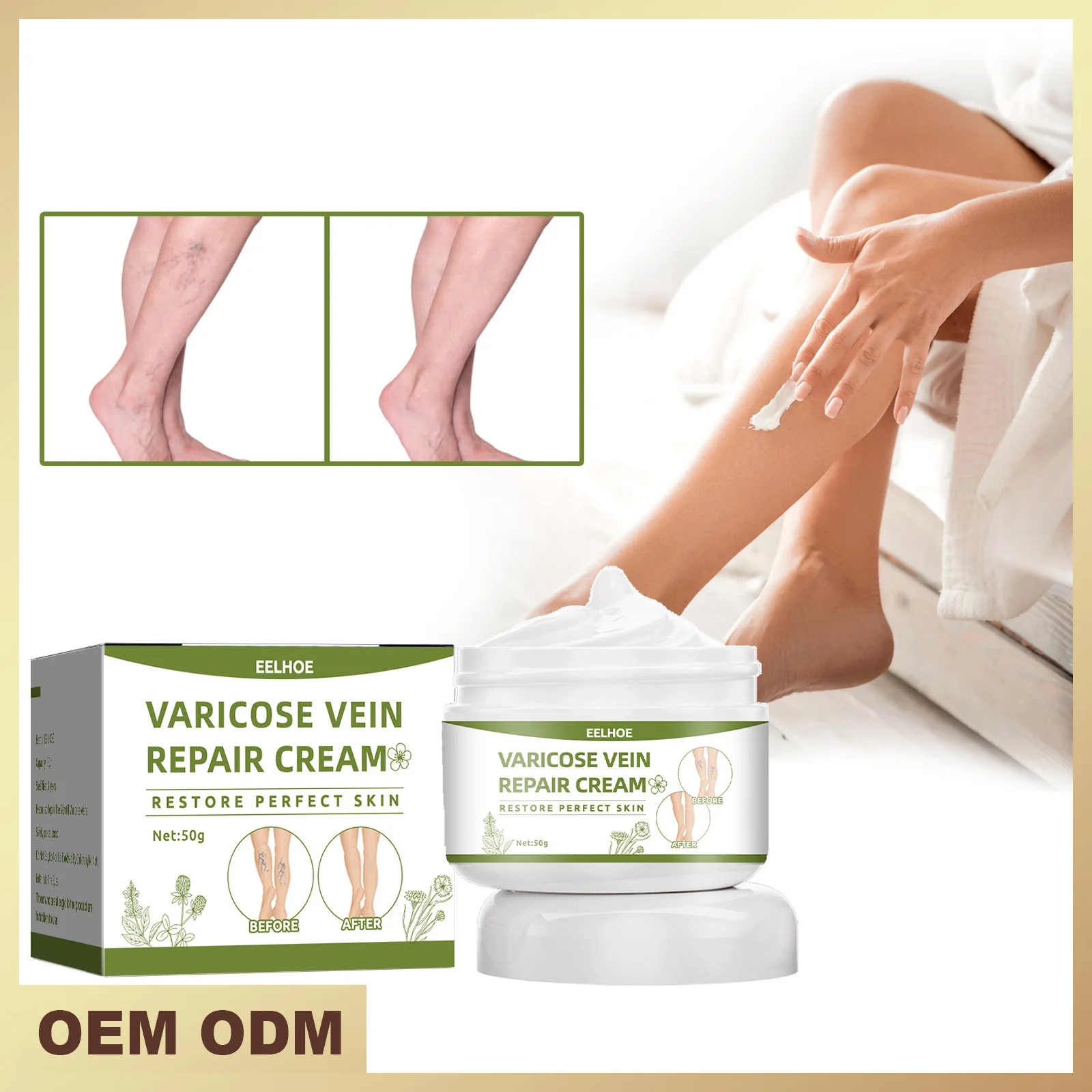 Effective Varicose Vein Repair Cream Tongmai Beauty Health Relieves Leg Varicose Pain Relief Earthworm Red Blood Silk Spider 50g