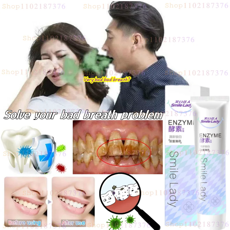 

Unisex Enzyme Toothpaste Anti-cavity Gum Toothpaste Mint Flavor 180g To Remove Yellow Teeth Stains Relieve Tooth Decay Pain