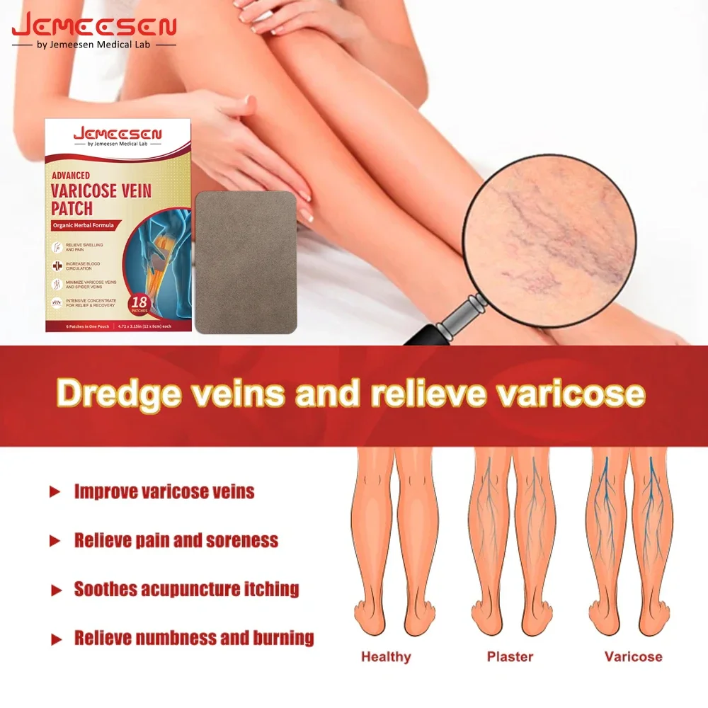 Улучшенные пластыри от варикозного расширения вен Jemeesen для улучшения