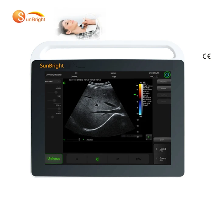 

China manufacturer Factory price portable high quality ultrasound machine medical obstetric ultrasound scanner