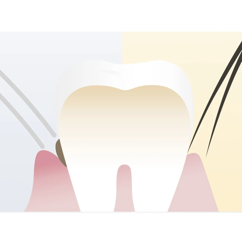

Зубная щетка Silko, зубная щетка для мужчин и женщин, зубная щетка с мягкой щетиной для мужчин и женщин